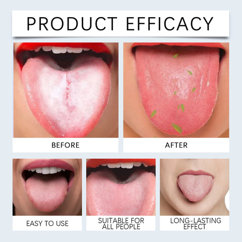 Tongue Cleaner For Remove Tongue Coating Inhibit Oral Bacteria Improve Bad Breath Freshener Tongue Cleansing Gel Toothbrush Set